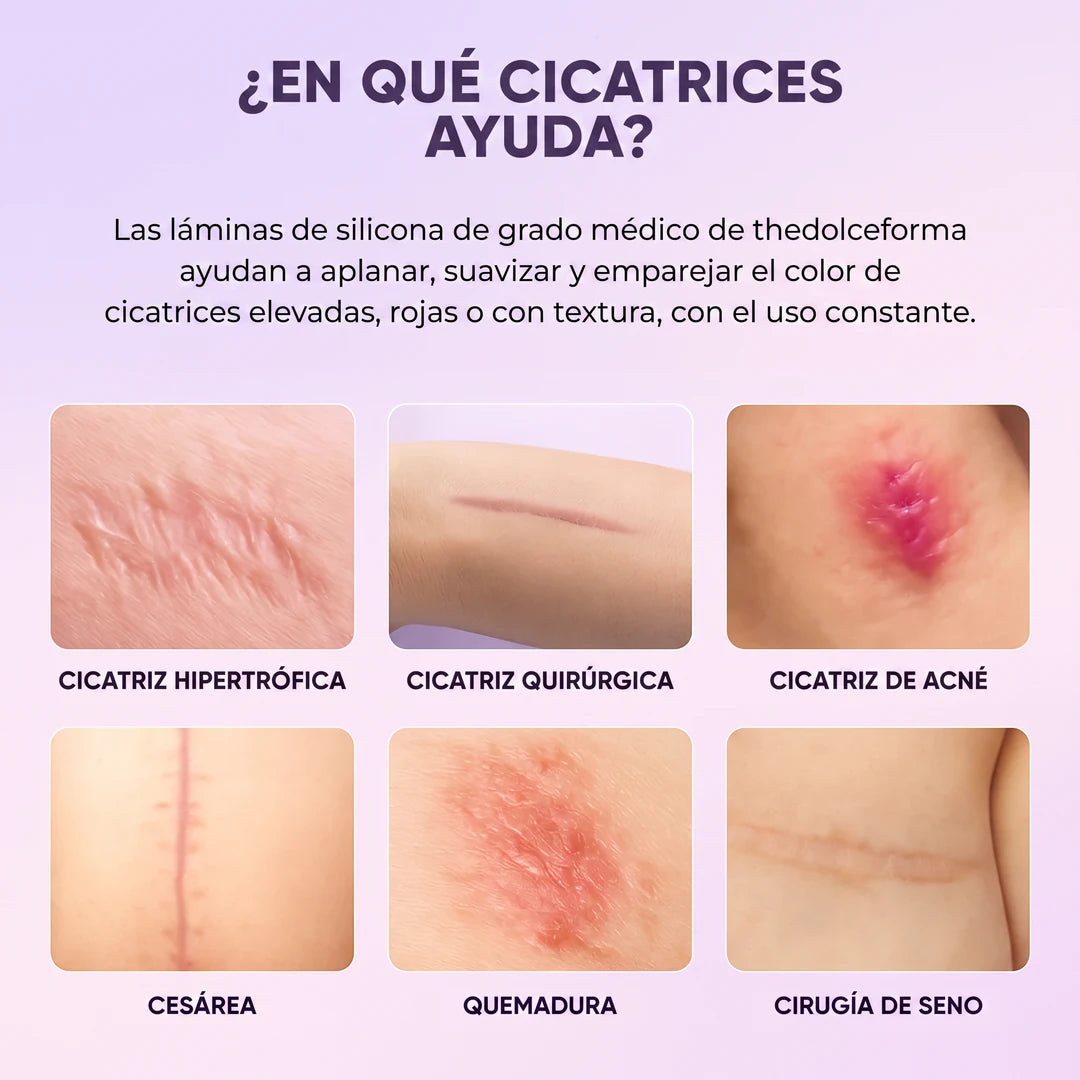 TheDolceForma™ Parches de Silicona con Colágeno
